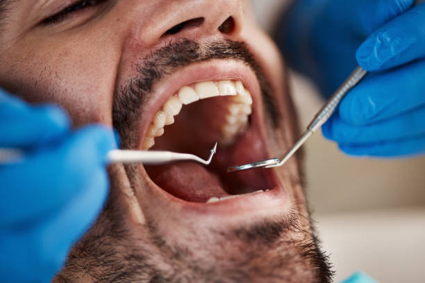 Best Urgent Tooth Repair  in Salida, CA